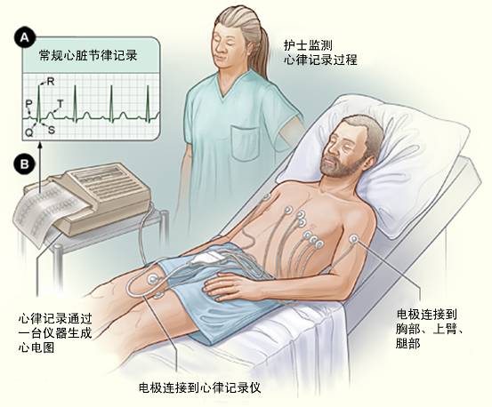 冠心病需要做哪些檢查？(圖1)