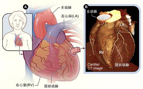 冠心病需要做哪些檢查？(圖2)