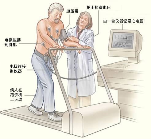 冠心病需要做哪些檢查？(圖3)